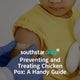 Preventing and Treating Chicken Pox: A Handy Guide