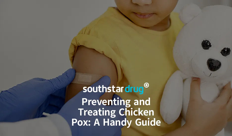 Preventing and Treating Chicken Pox: A Handy Guide